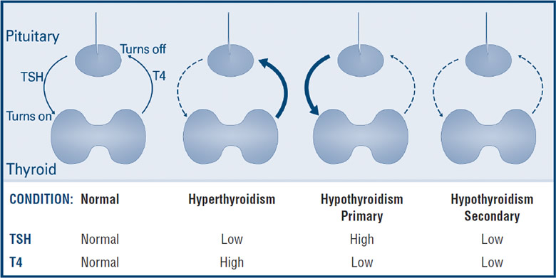 Thyroid Level Range Chart