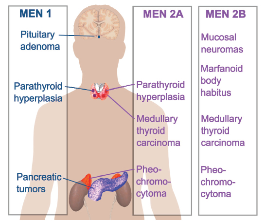 MEN1, MEN 2A, MEN 2B