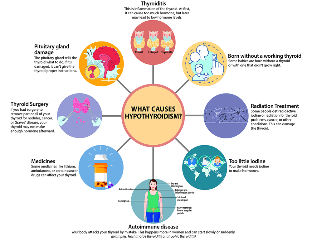 Adult Hypothyroidsim Diagram